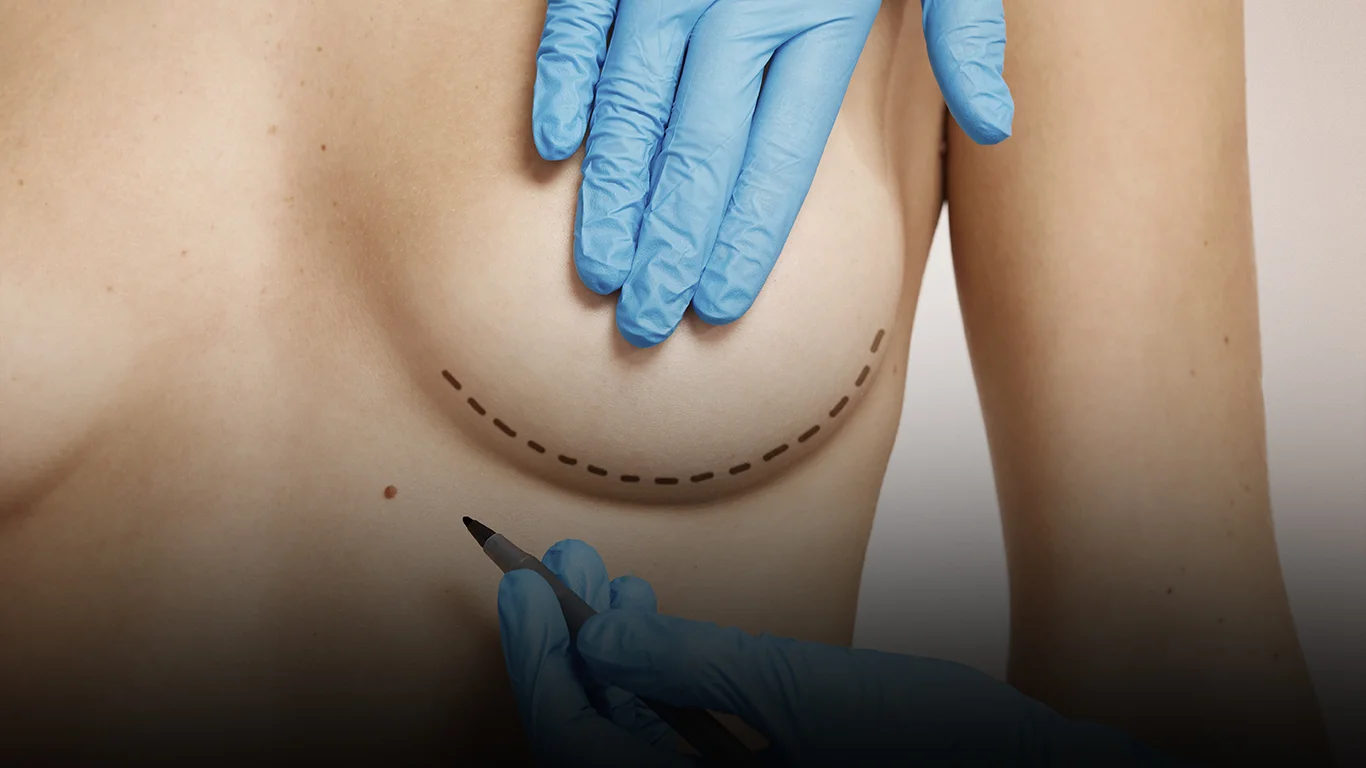 Aumento de senos con implantes de alta calidad, resultados naturales y seguros en Riobamba